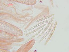Strossmayeria basitricha