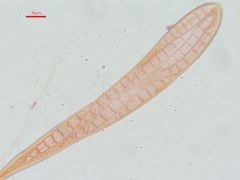 Strossmayeria basitricha