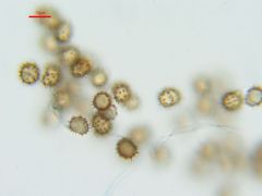 Tomentella fuscocinerea