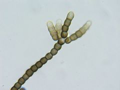Torula herbarum