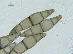 Trematosphaeria hydrela