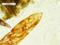Trematosphaeria hydrela