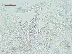 Tryblidiopsis pinastri