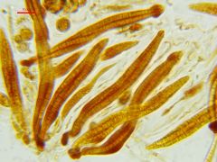 Tubeufia cerea