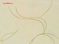 Vibrissea decolorans