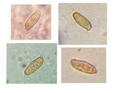 Xerocomellus fennicus